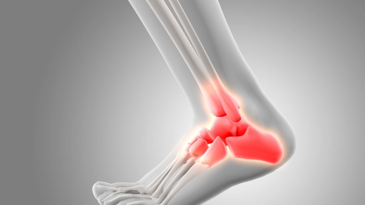 Foot and ankle pain