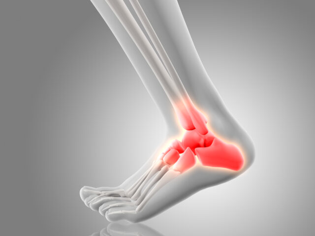 Foot and ankle pain