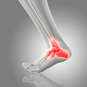 Foot and ankle pain