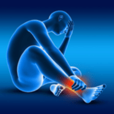 A foot with an ankle sprain condition