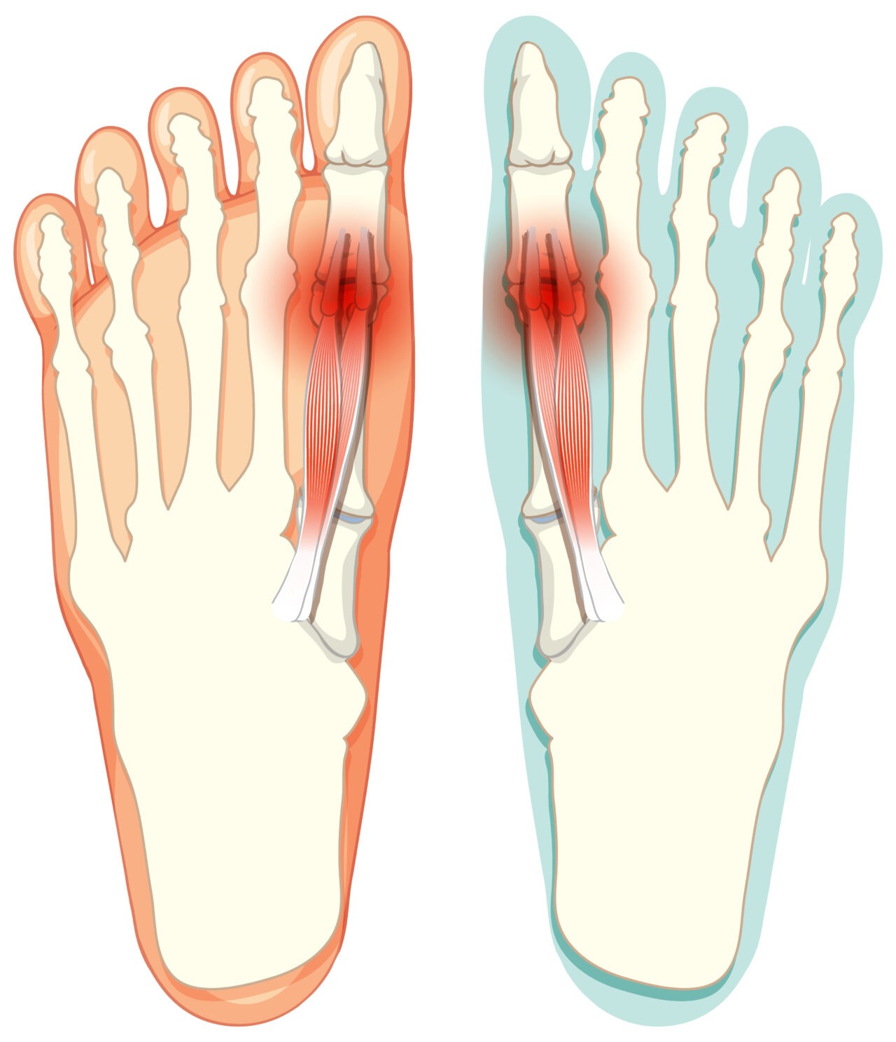 Comprehensive Guide to Foot and Ankle Reconstruction Surgery