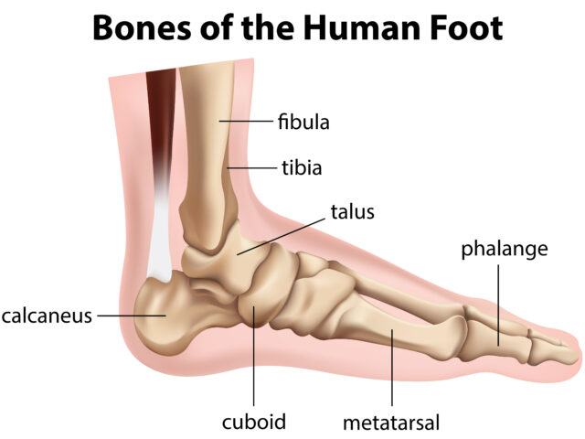 Charcot arthropathy treatment